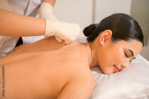 Beautiful Woman Received acupuncture treatment on back by therapist, chinese medicine treatment, health and healing concept.