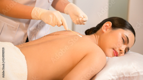 Obraz na plátně Beautiful Woman Received acupuncture treatment on back by  therapist, chinese medicine treatment, health and healing concept