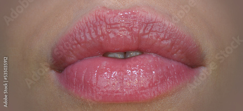 Filler injections  tender lips. Sensual female mouth. Close up glossy luxury mouth  glamour lip concept.