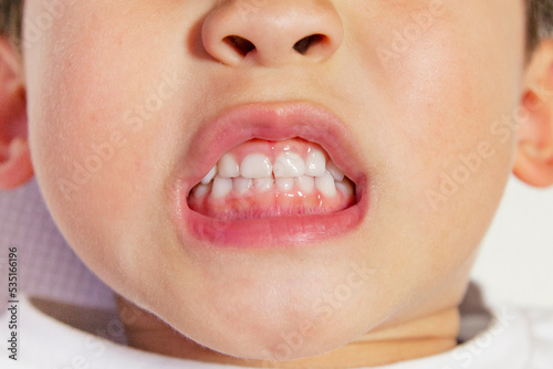 white teeth of a child isolated on a white background