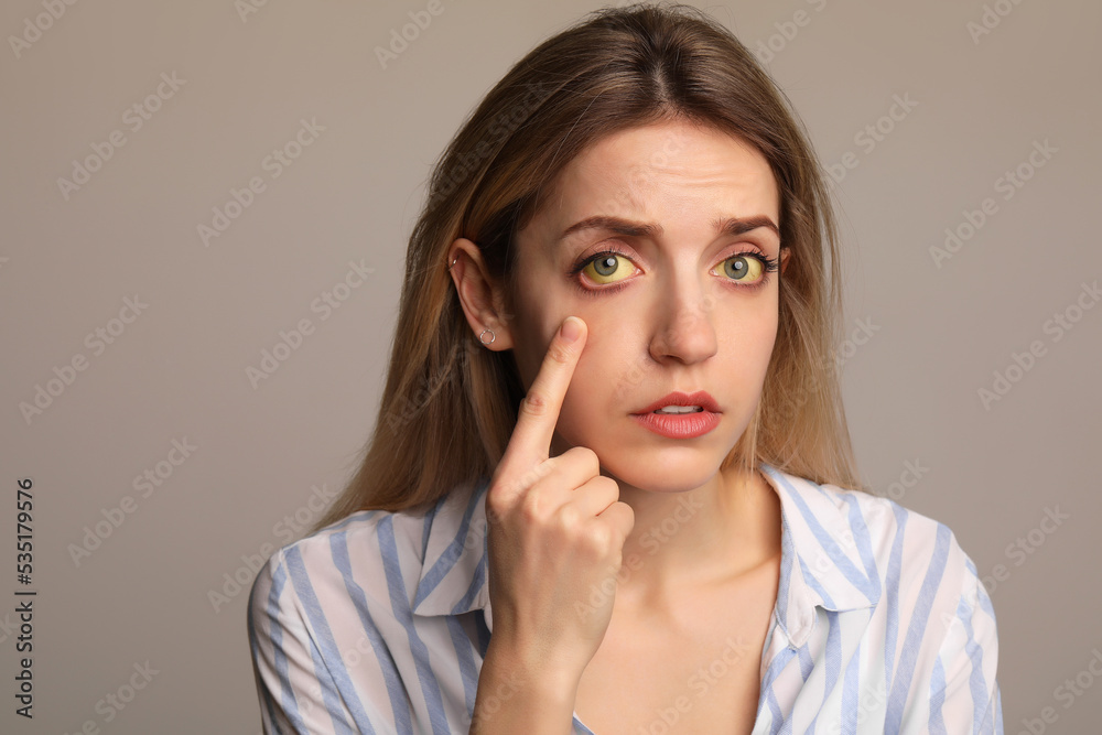 Woman checking her health condition on grey background. Yellow eyes as symptom of problems with liver Woman checking her health condition on grey background. Yellow eyes as symptom of problems with liver