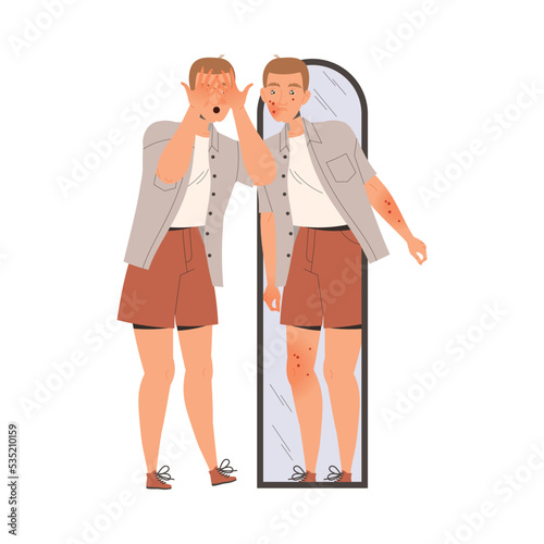 Man Character Suffering from Neurodermatitis Standing Near Mirror with Small Red Spots on His Body Skin Vector Illustration