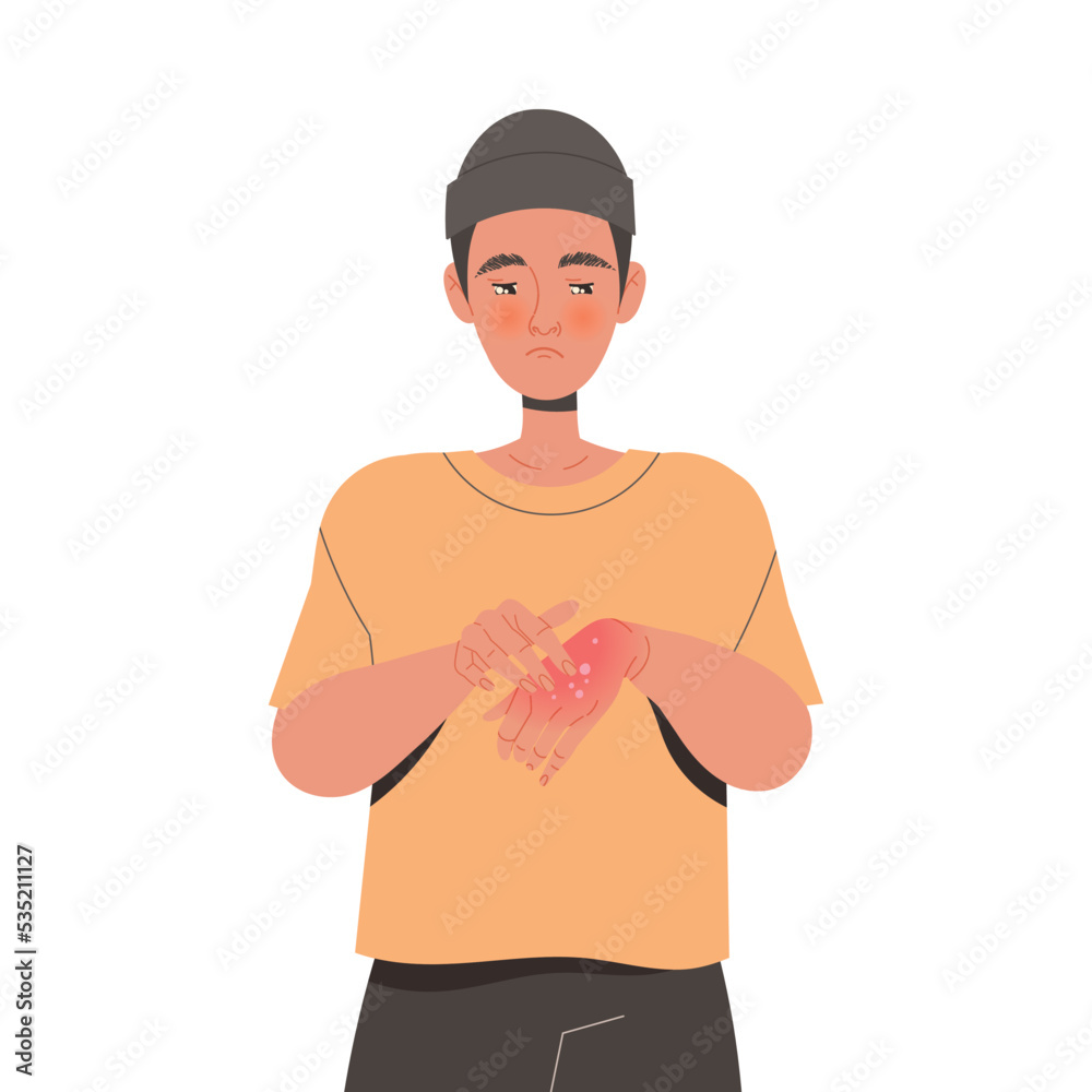 Fototapeta premium Man Character Suffering from Neurodermatitis Itching, Excessive Rubbing and Scratching Skin on His Hand Vector Illustration