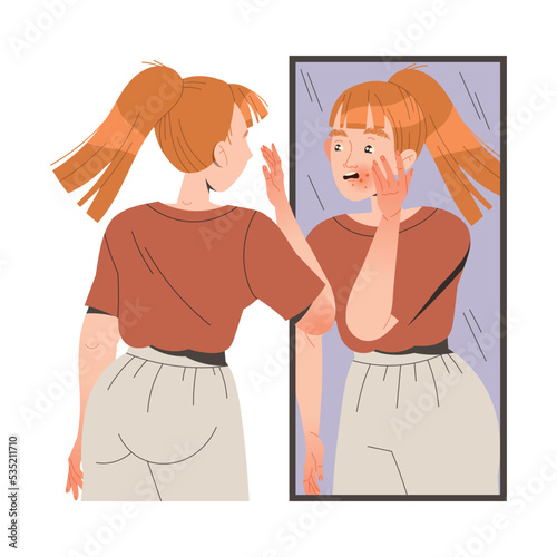 Woman Character Suffering from Neurodermatitis Looking in the Mirror Having Her Face Skin Covered with Red Spots Vector Illustration