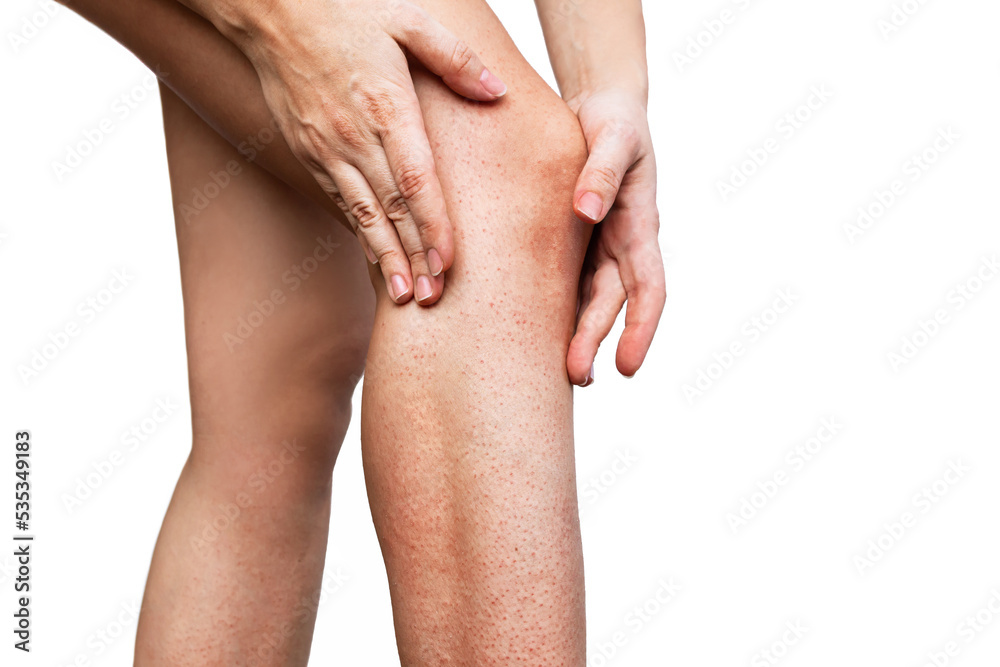 Irritation and redness on sensitive skin after epilation. Cropped shot of young woman touching her leg with her hands after depilation isolated on a white background. Hair removal with wax, epilator Irritation and redness on sensitive skin after epilation. Cropped shot of young woman touching her leg with her hands after depilation isolated on a white background. Hair removal with wax, epilator
