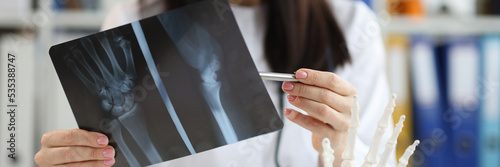 Canvas Print Doctor traumatologist examines x-ray with arm injury closeup