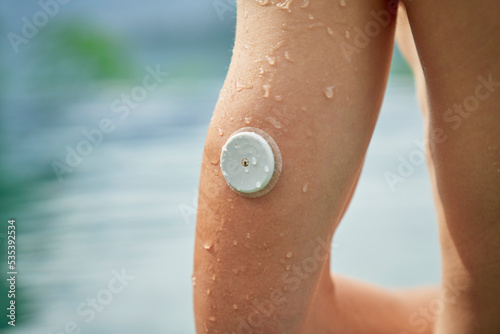 Diabetes patient standing in a swimming pool with an waterproof CGM photo