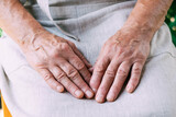 The hands of elderly woman lie on her knees, elderly person, caring for the elderly, women's hands