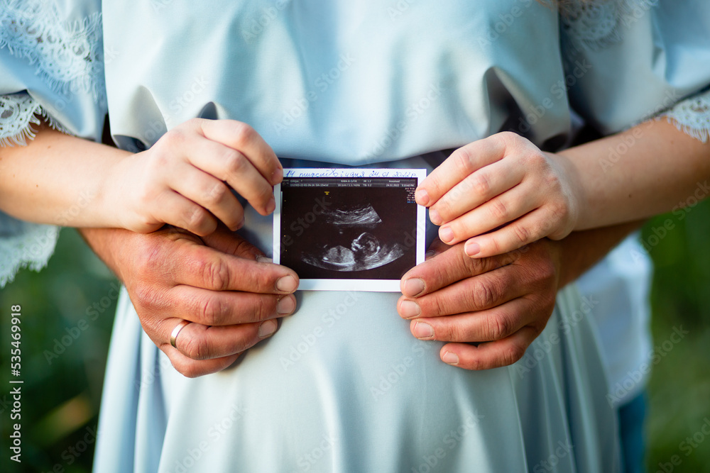 Vinnytsia, Ukraine. September 18, 2022. Expectant parents hold an ultrasound photo of a baby in a mother's womb Vinnytsia, Ukraine. September 18, 2022. Expectant parents hold an ultrasound photo of a baby in a mother's womb