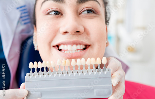 Dentist holding a set of implants with various shades of tone. Patient selecting the shade of dental implant. Implant tooth shade selection, Dentist showing dental prosthesis shades to patient