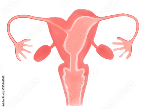 子宮形態異常の種類（Class U4 単角子宮） photo