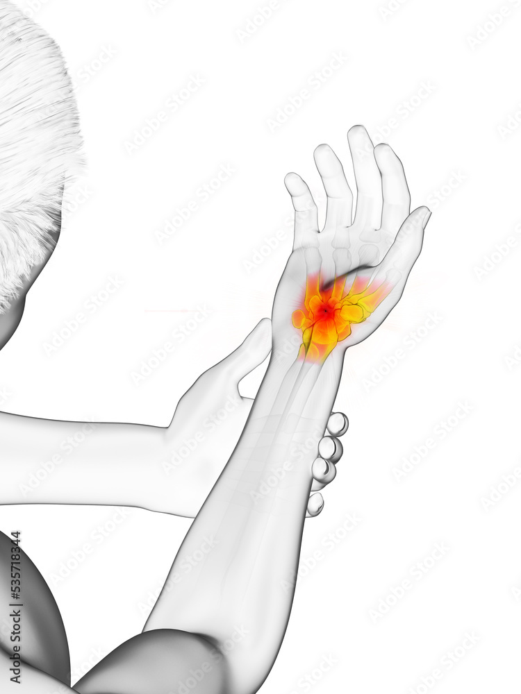 3d rendered medically accurate illustration of a man having a painful wrist - obrazy, fototapety, plakaty 