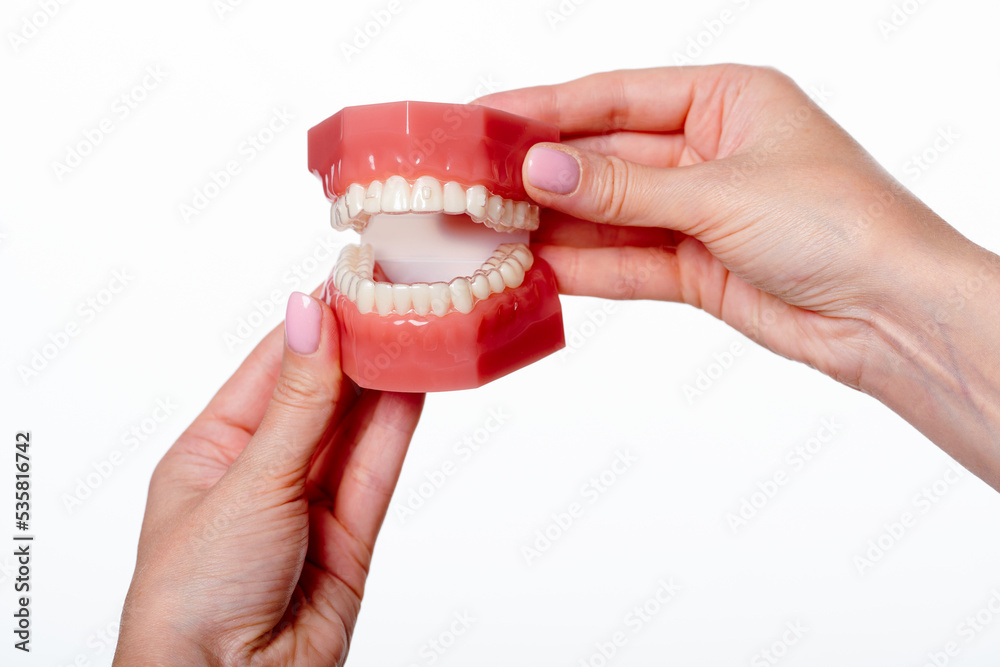 Dental model with orthodontic appliance with transparent braces. Jaw