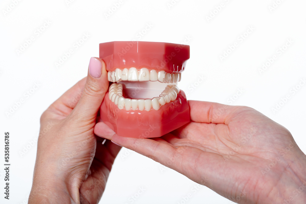 Dental model with orthodontic appliance with transparent braces. Jaw