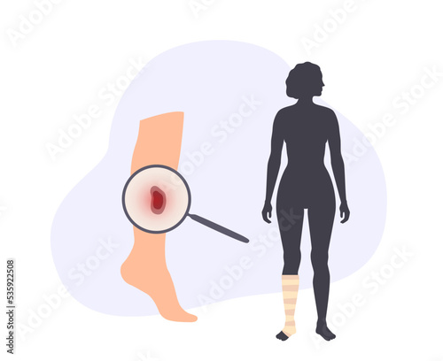 Human leg injury