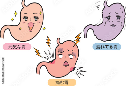 いろんな状態の胃のセット