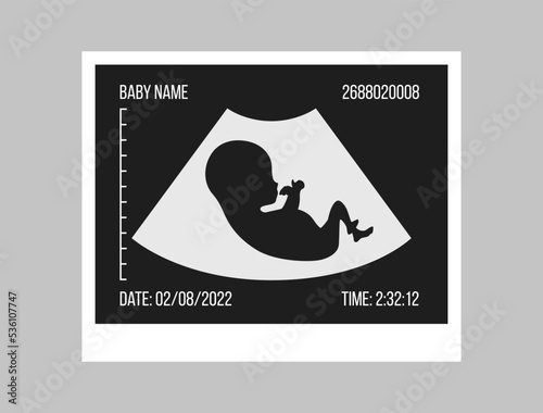 Pregnancy ultrasound black and white picture. Baby in the womb. Little baby silhouette medical photo. Pregnant woman clinic examination. Embryo human vector illustration. Sonography test. Belly scan