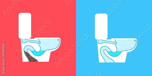 Vector toilet detergent illustration. Garbage stuck in a plumbing pipe. Cleaning service advertising poster. Home bathroom problems. Sanitary home clean method. Ceramic dirty blocked problem. WC wash