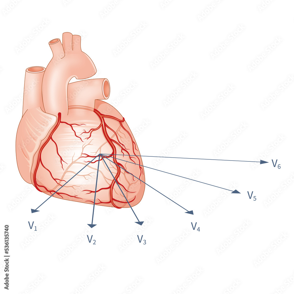 In the conventional 12 lead ECG, the chest lead system represents the