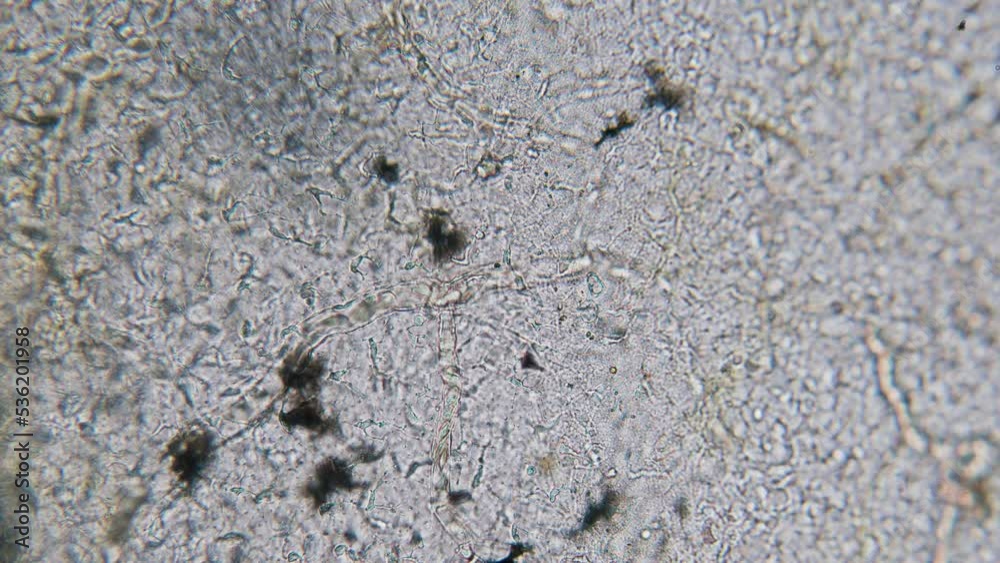 Blood erythrocyte movement in blood vessels capillaries microscopy in tadpole tail Blood erythrocyte movement in blood vessels capillaries microscopy in tadpole tail