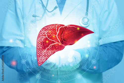 Human liver anatomy, Diseased liver, liver cancer, cross section. 3d illustration