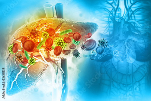 Medically accurate illustration of diseased liver. Virus infected liver. 3d illustration photo