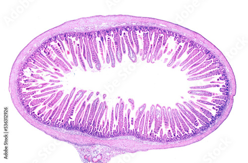 Small intestine. Intestinal villi photo