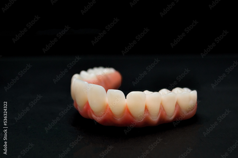 Upper part of a denture Upper part of a denture