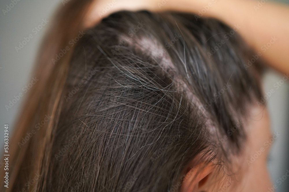 Obraz premium Gray hairs on the head of a young girl. Long gray hair. The initial stage of gray hair. The problem of gray hair in women.