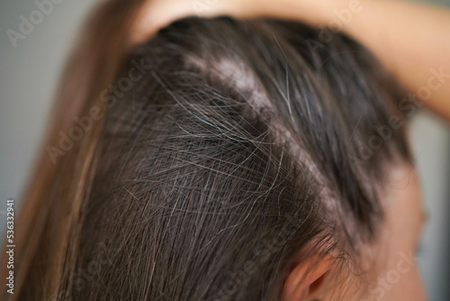 Gray hairs on the head of a young girl. Long gray hair. The initial stage of gray hair. The problem of gray hair in women.