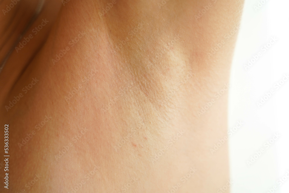 Women's armpit close-up. Thin and sparse hair on a female armpit. The result after completing an incomplete course of laser hair removal. Women's armpit close-up. Thin and sparse hair on a female armpit. The result after completing an incomplete course of laser hair removal.