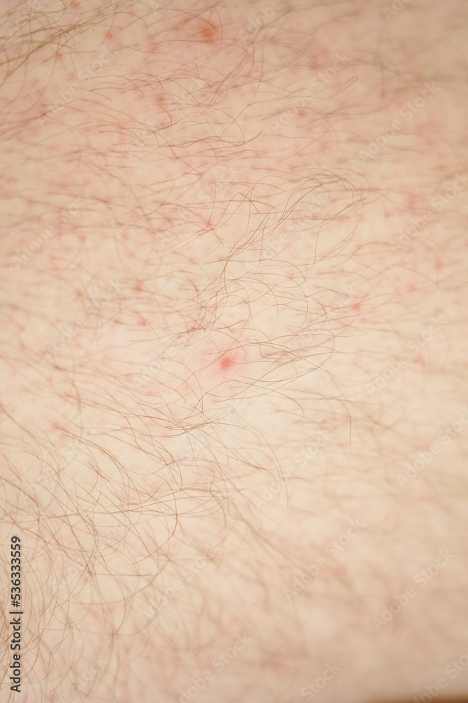 Fototapeta premium Close-up of hairy skin. Hair on a man's leg