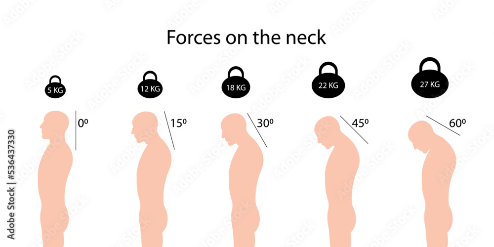 Forces on the neck. Angles and weights. Improper posture symptoms. Spinal curvature - obrazy, fototapety, plakaty 