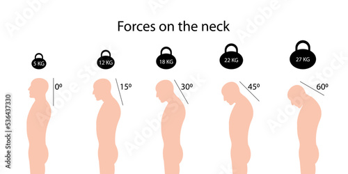 Forces on the neck. Angles and weights. Improper posture symptoms. Spinal curvature