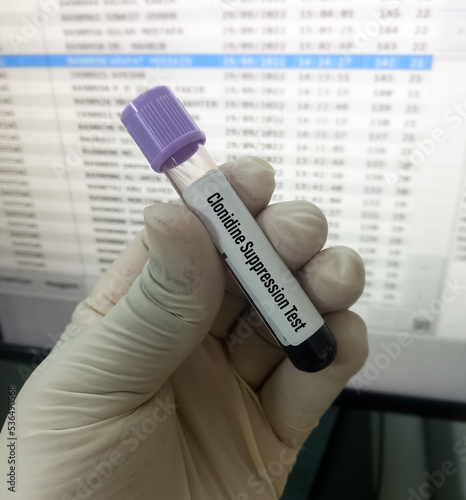 Blood sample for Clonidine Suppression test to diagnosis of pheochromocytoma. photo