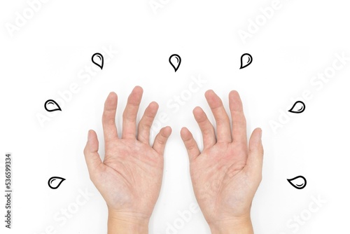 Palmar aspect of sweaty and oily hands. Sweating palms. Isolated on white.