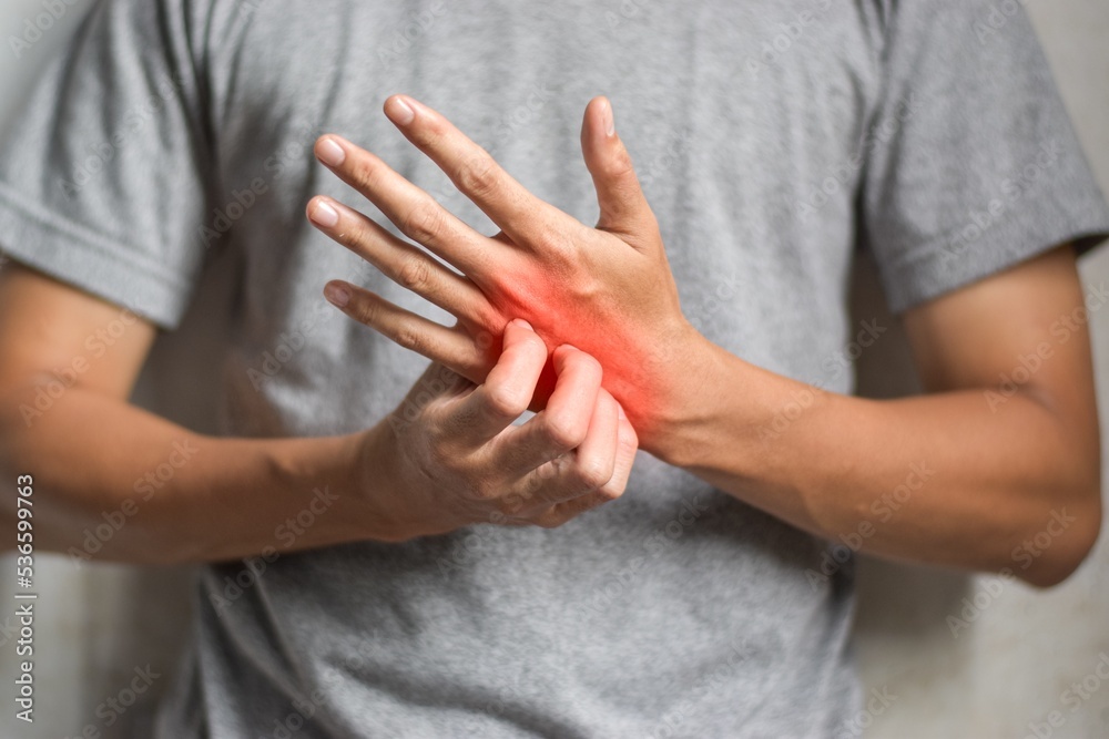 Asian man scratching his hand. Concept of itchy skin diseases such as scabies, fungal infection, eczema, psoriasis, rash, allergy, etc. Asian man scratching his hand. Concept of itchy skin diseases such as scabies, fungal infection, eczema, psoriasis, rash, allergy, etc.