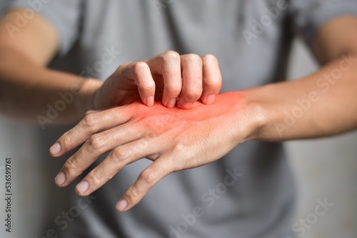 фотографія Asian man scratching his hand