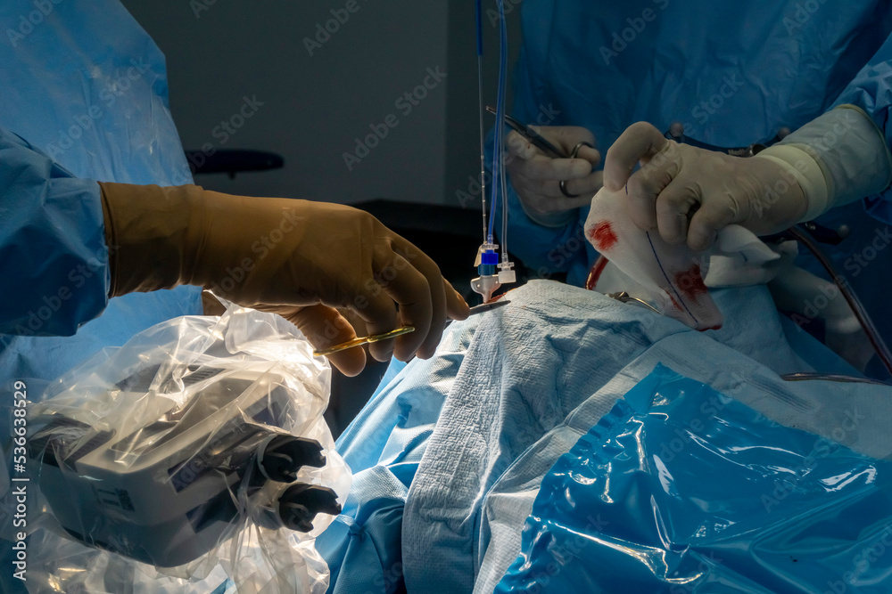 Step by step Visualase is an MRIguided laser ablation system used to