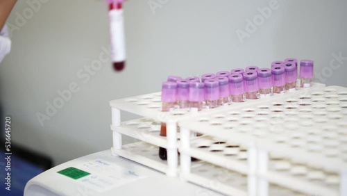 Female Laboratory Scientist Conducts Experiment in Science lab looking at blood sample