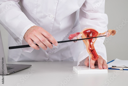 doctor gynecologist pointing model of female reproductive system on his desktop photo