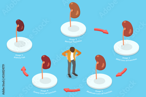 3D Isometric Flat Vector Conceptual Illustration of Kidney Disease, Stages of Renal Failure