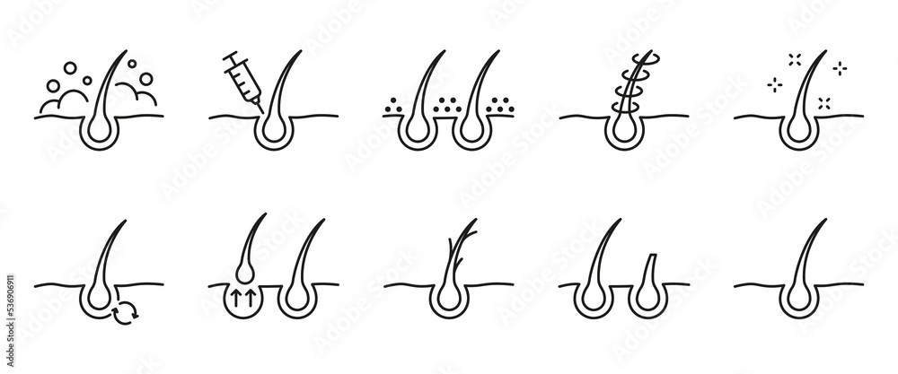 Hair Care and Loss Problem. Hair Cosmetic Line Icons. Shampoo, Dandruff, Haircut, Growth and Alopecia Outline Icon. Treatment and Problem of Hair. Editable Stroke. Isolated Vector illustration - obrazy, fototapety, plakaty 