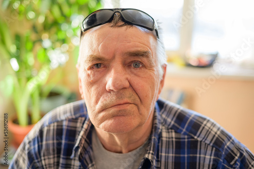 Aged man with facial nerve paralysis, Bell's palsy. photo