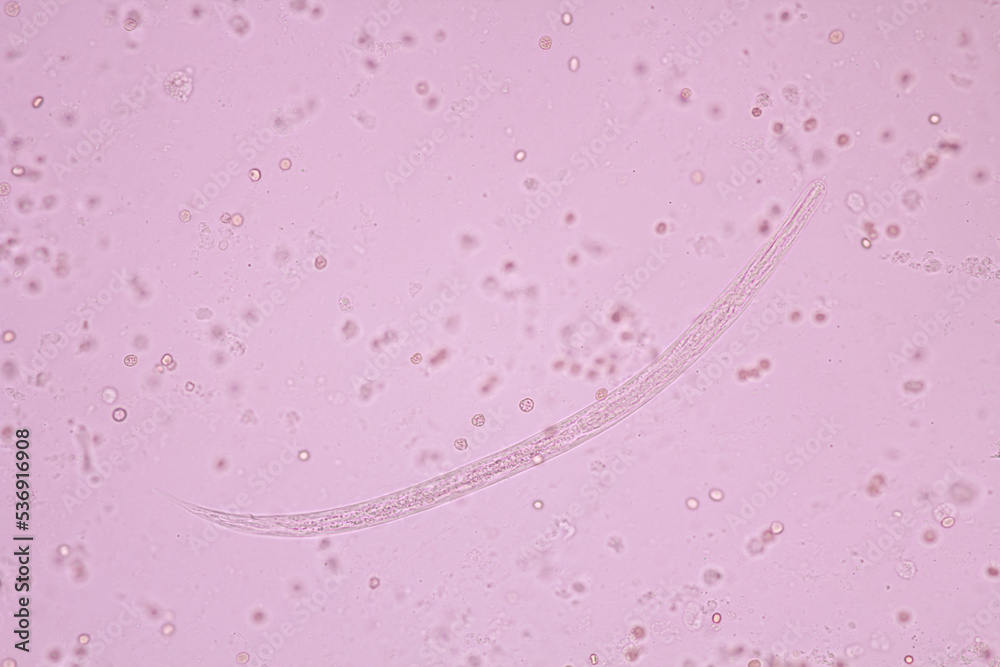 View in microscopic Strongyloides stercoralis or threadworm in human