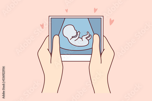 Hands of person holding scan of embryo waiting for baby birth. Future mother with ultrasound picture of baby. Motherhood concept. Vector illustration. 