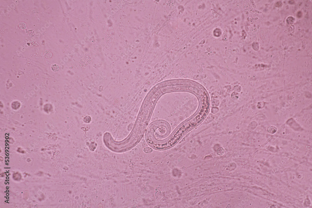 View in microscopic Strongyloides stercoralis or threadworm in human