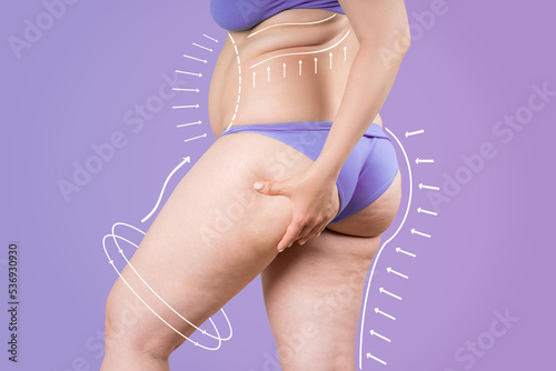 Buttocks, hip, back liposuction, fat and cellulite removal concept, overweight female body with painted surgical lines and arrows