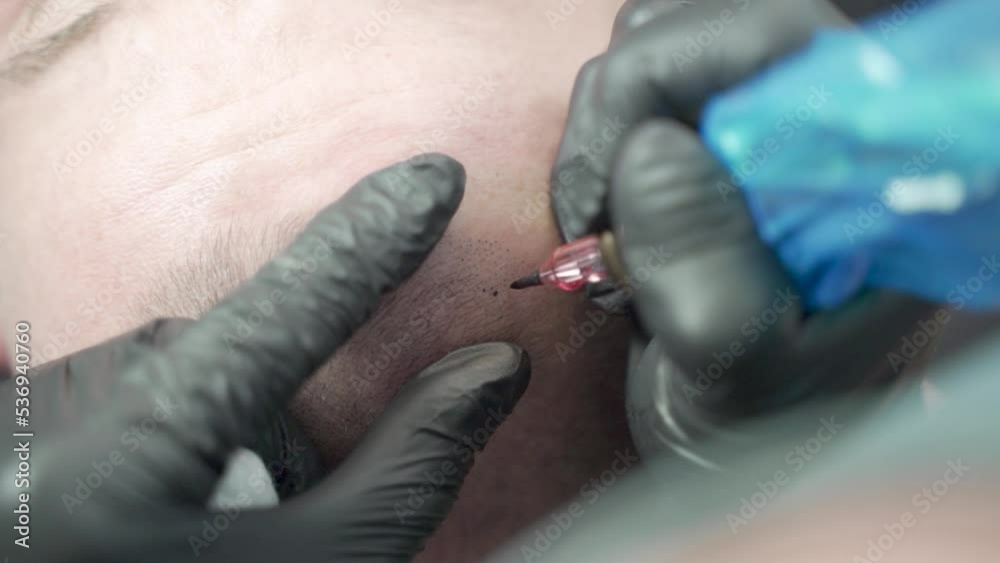 Man in micropigmentation treatment. salon. Making hair on bald scalp. Tattooing head. Hair micro pigmentation. Using professional equipment. Zoom, closeup. Slowly tatooing.