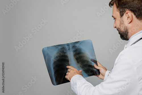 Cropped male doctor man wear white medical gown suit work in hospital hold fluorography roentgen X-ray of lungs with pneumonia isolated on plain grey background studio . Healthcare medicine concept. photo
